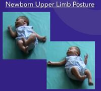 Newborn upper limb posture.jpg
