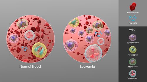 Leukemia- SAG.jpg