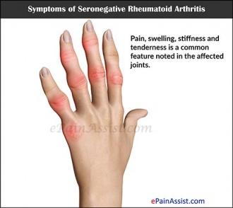 http://www.epainassist.com/arthritis/seronegative-rheumatoid-arthritis