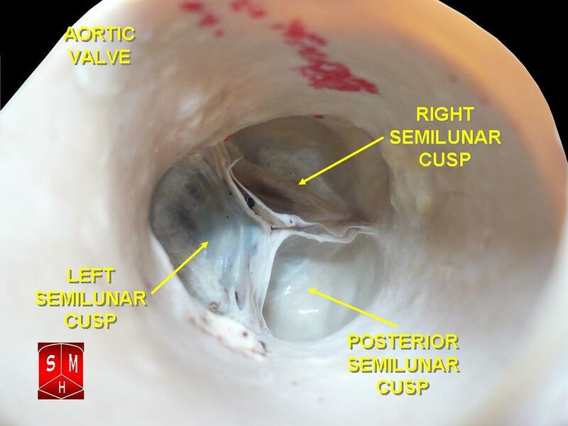 File:Aortic valves.jpeg