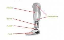 TT prosthetic components