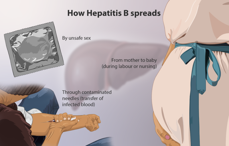 File:Hepatitis B.png