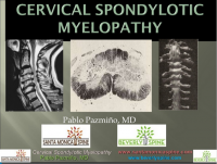 Cervical spondy myelopathy title screen.png