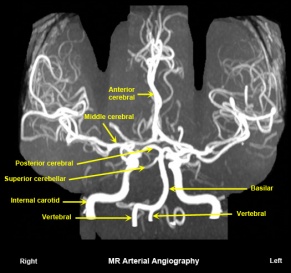 Mr arterio angiography.jpg