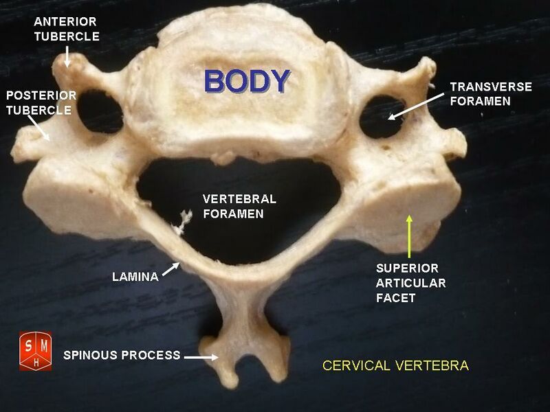 File:Cervical vertebrabifud.jpg