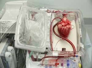 Heart donor.jpeg