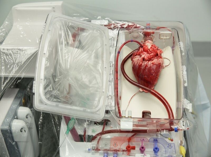 File:Heart donor.jpeg