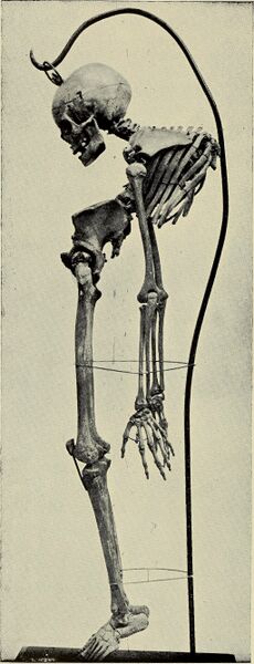 File:Pott vertebra Museum (1910) (14576501749).jpeg