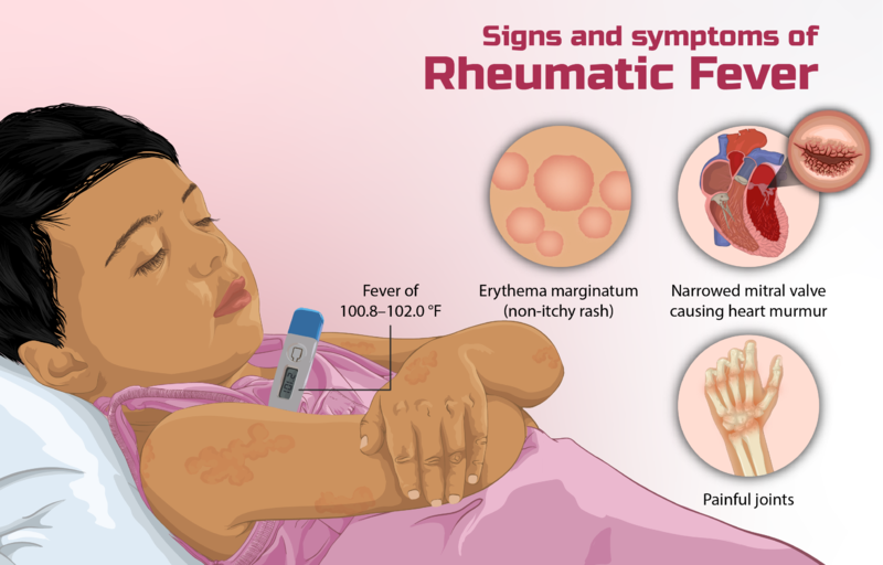 File:Rheumatic Fever.png