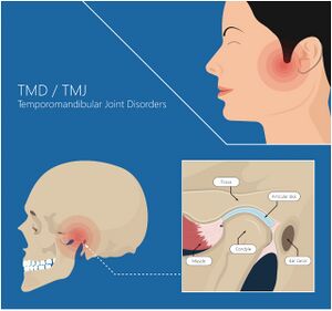 Anatomy of the Temperomandibular Joint - Physiopedia