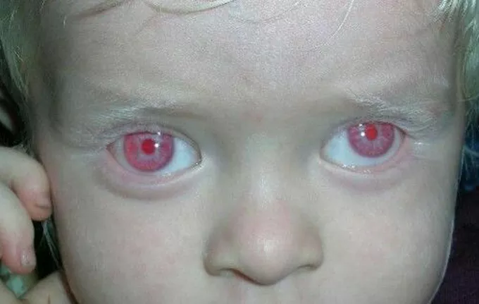 File:Red eyes.webp