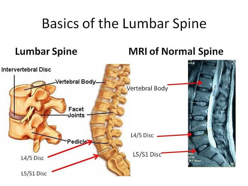 File:Basics of lumbar spine.jpg