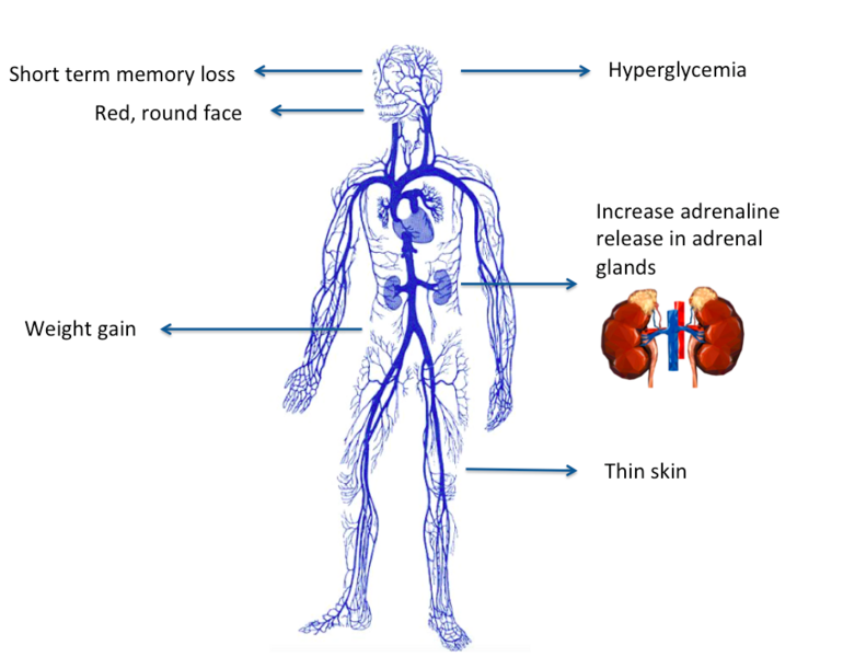 File:Cushing's syndrome diag.png