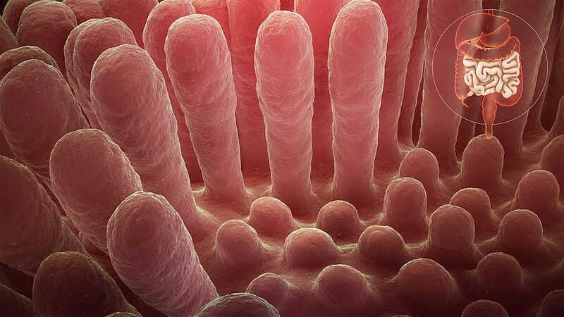 File:Inflammed mucous layer of the intestinal villi depicting Celiac disease.jpeg