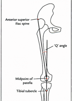 Image result for q angles of the knee
