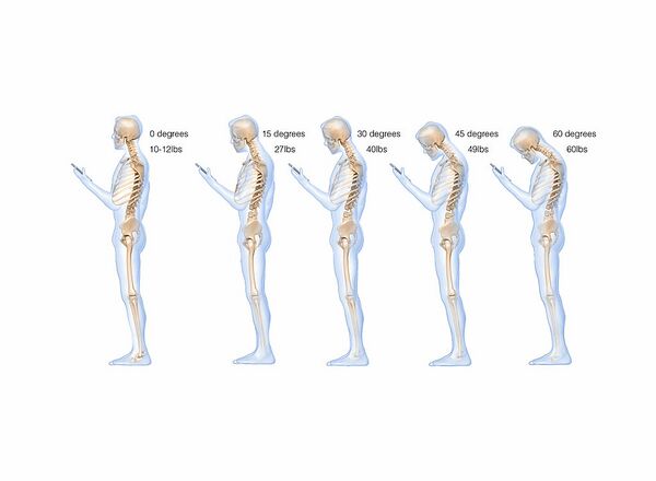 Texting and Mobile Usage Does to Your Spine.jpeg.jpeg