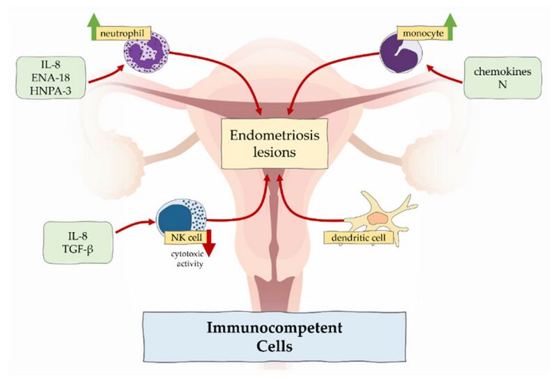 File:Immunocompetent cells in endometriosis.jpg