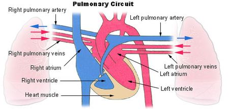 pulmonary artery hypertension