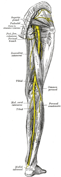 Sciatic Nerve Injury - Physiopedia