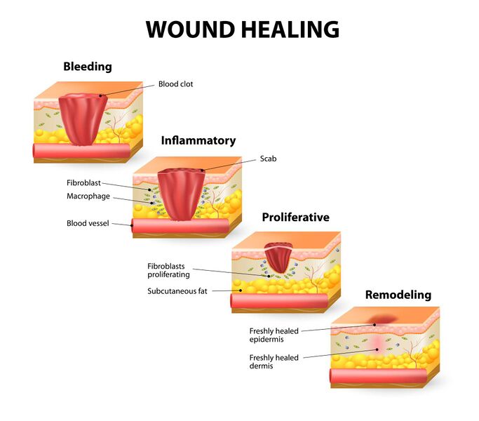 File:Stages of Healing.jpg